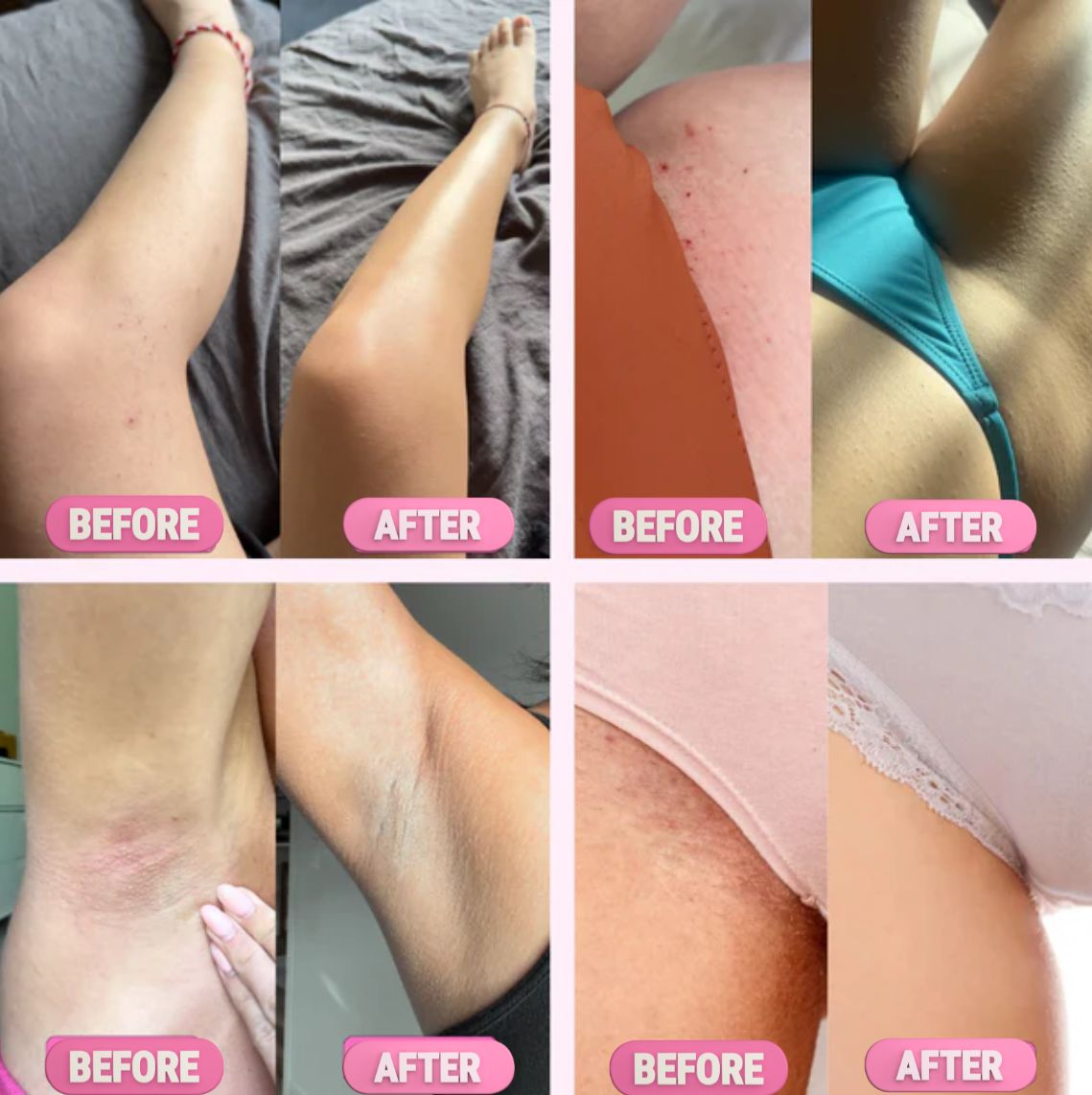 Electric Razors for Women